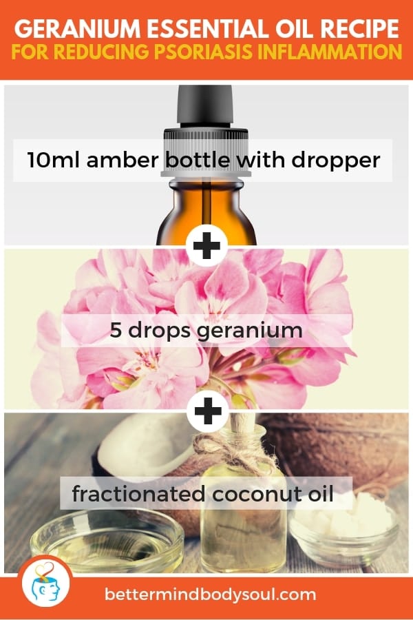 21 Essential Oil Recipes for Psoriasis
