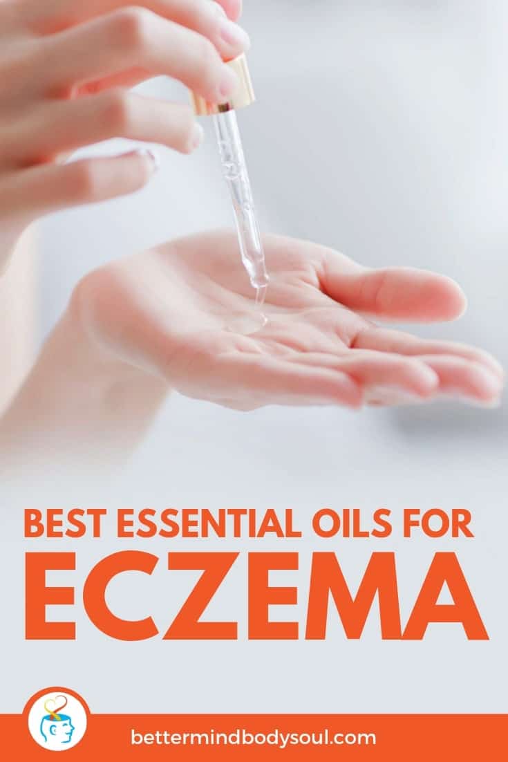 10 Best Essential Oils For Eczema 2022 Reviews